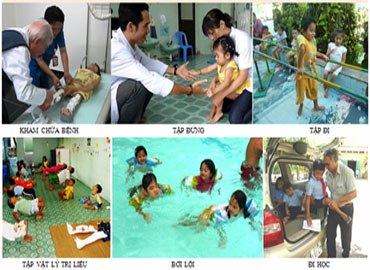 Bệnh xương thủy tinh