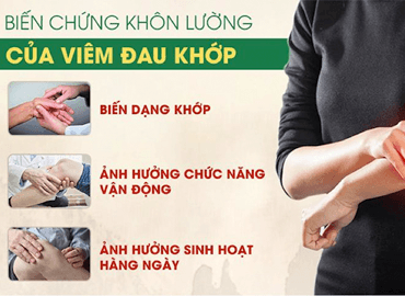 Bệnh viêm đa khớp là gì và những điều cần biết