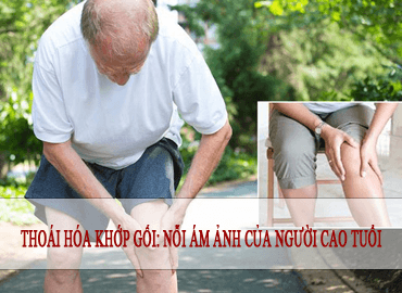Thoái hóa khớp gối: Nỗi ám ảnh của người cao tuổi
