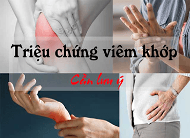 Viêm khớp phản ứng: Nguyên nhân, triệu chứng, chẩn đoán và điều trị